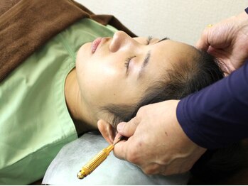 いなほ はりきゅう整骨院 東新宿/美容鍼施術/手順11