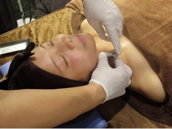 やさしくハリして 静岡茶町総合鍼灸院の写真/【ここが自慢！】肌質改善ケアでツルツル陶器肌。首のシワ改善も可能の技術。