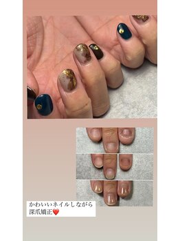 矯正中もアートを楽しめます