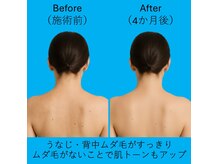 ブロッサム(BLOSSOM)の雰囲気(もう誰にも見られるのが怖くない肌へ)