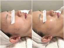 フォー(For...)/ブライダル美肌|クリスティーナ