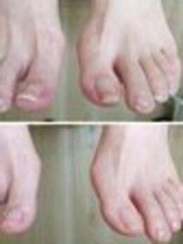 リゼラアンドコー 船橋店/ドイツ式フットケア専門店