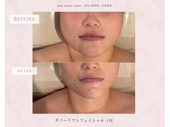 スパジュエル(SPA JEWEL)/