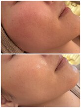 ニコリ(Nicori)/Nicori Beauty Salon