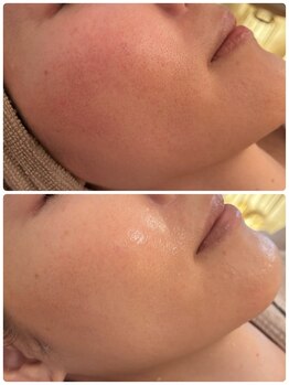 ニコリ(Nicori)/Nicori Beauty Salon