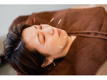 たから鍼灸院の写真/【たるみ改善】土台から整え深くなったほうれい線に◎美容鍼×フェイシャル×頭蓋骨小顔矯正でハリツヤUP◇