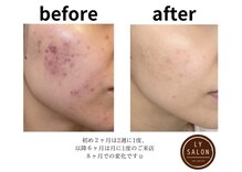 エルワイ サロン(LY SALON)
