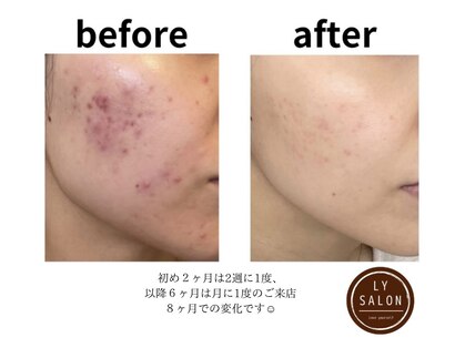 エルワイ サロン(LY SALON)の写真