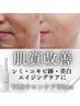 【美白・くすみ・ニキビダメージ跡に】VOS肌質改善ケア+美容液付き(WHITE)