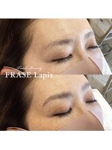 フレイズラピス(FRASE Lapis)/【ハリウッドブロウリフト】