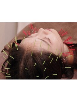 鍼灸施術を受けたい