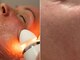 ティーボックスボーテ(TBOX beaute)の写真/【1回16,500円で本格エイジングケア】しわケア/ほうれい線へ速攻効果!ハリのある若々しい印象に◎