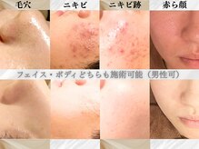 アクール(Accueil)