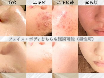 アクール(Accueil)