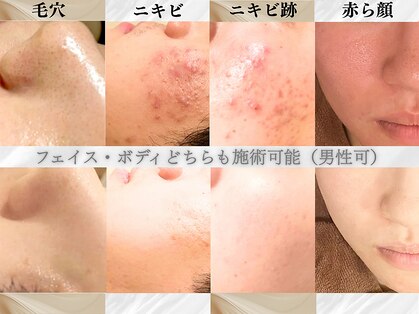 アクール(Accueil)の写真