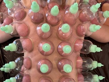 ウラヤス 恵比寿(Urayasu)の写真/《すべてのコースにカッピング付き！》放置時間無し、巻肩・首肩凝り・腰痛・冷え・むくみ・不眠の改善に◎