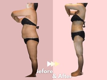 キレイサローネ 表参道店(KIREI SALONE)/☆ビフォーアフターのご紹介☆