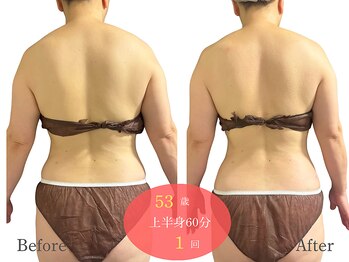 アルピナ(ALPINA)/ウルトランスフォーマー