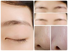 トータルビューティ ノイド(Noid)/いちご鼻撃退＋美眉毛WAX脱毛