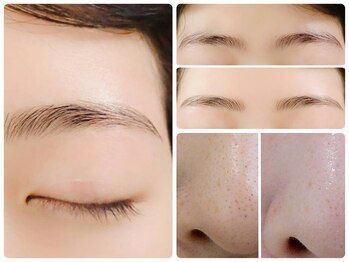 トータルビューティ ノイド(Noid)/いちご鼻撃退+美眉毛WAX脱毛