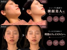 クアダ 天神(QUADA)/ 痩身/腰痛/骨盤矯正