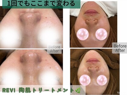 エクレ(eclat)の写真