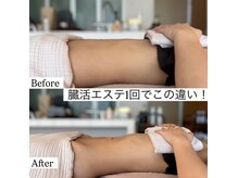 サニー(SUNNY)の雰囲気（話題の臓活エステ★五臓六腑の働き・巡り・血流を整える◎腸もみ）