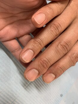 エクレネイルズ(eclait nails)/ケアafter