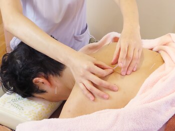 晴レヤカ鍼灸治療院/鍼を刺されるのが不安な方に
