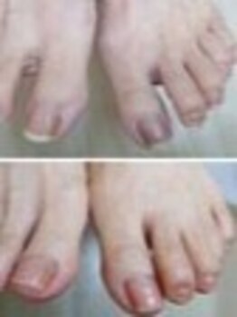 リゼラアンドコー 船橋店/ドイツ式フットケア専門店