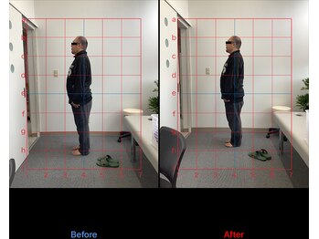 リード整骨院(LEAD整骨院)/姿勢改善、猫背、反り腰