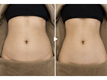 ラ ヴィレ ボーテ(La vraie beaute’)の写真/40、50代の大人女性からも高支持率！年齢と共に変わるボディラインのお悩みに（リンパ/リンパマッサージ）