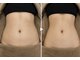 ラ ヴィレ ボーテ(La vraie beaute’)の写真/40、50代の大人女性からも高支持率！年齢と共に変わるボディラインのお悩みに（リンパ/リンパマッサージ）