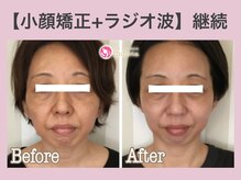 アンリエッタ(Unlieta)/【お顔全体の変化】