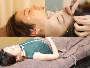 整体サロンEX イーエックス鍼灸院の写真/【三河初！細胞レベルの肌質改善】美容鍼灸×水素吸入◆初回限定¥13,200→¥5,980！