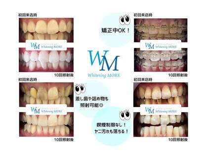ホワイトニング モア(Whitening MORE)の写真