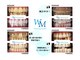 ホワイトニング モア(Whitening MORE)の写真