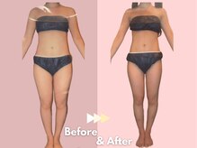 キレイサローネ 表参道店(KIREI SALONE)/☆ビフォーアフターのご紹介☆