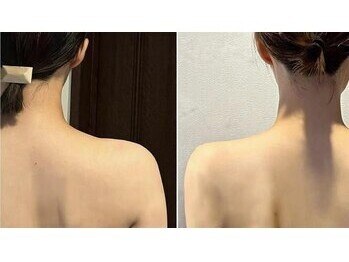 5つ星/◆肩こりマッサージで劇的変化