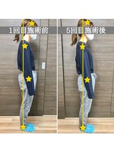 シェア 人形町店(Chare)/【小顔・骨盤矯正・О脚・整体】