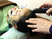 いなほ はりきゅう整骨院 東新宿/美容鍼施術/電子灸