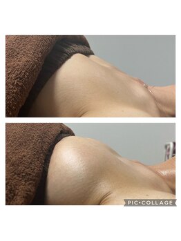 リボーン(REBORN)/バストでお悩みの方！