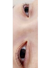 コア(Koa)/上下パリジェンヌリフト