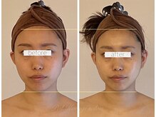 パル コルギサロン(Pal. Korugi salon)/コルギビフォーアフター