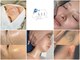 ビーエルティー(blt)の写真