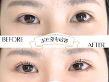 ストライプ 志木店/左右差をととのえる