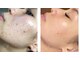 フランジスパ(FRANGI SPA)の写真