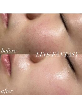 ラインファンタジー 武庫之荘店/【クリスティーナアンストレス】