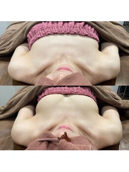 ロココ 四日市店(Rococo)/見た目年齢はバストで変わる