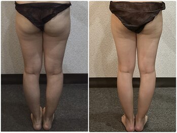 美容整体 ウェリナ 蟹江院/小顔矯正/骨盤矯正/美脚サロン